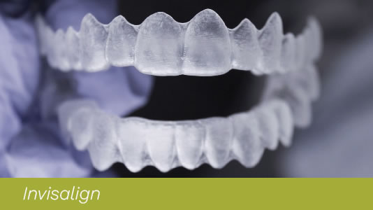 invisalign video