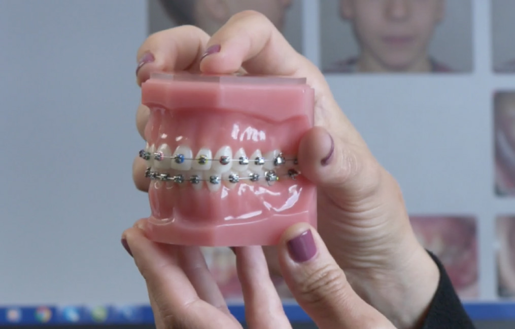 surgical orthodontics vs tads non surgical